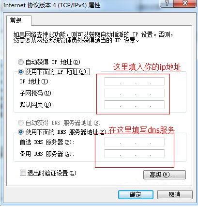 本地連接ip設置